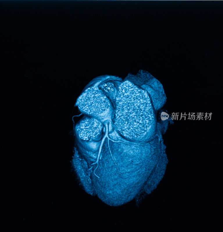 人类心脏MRI 3D图像